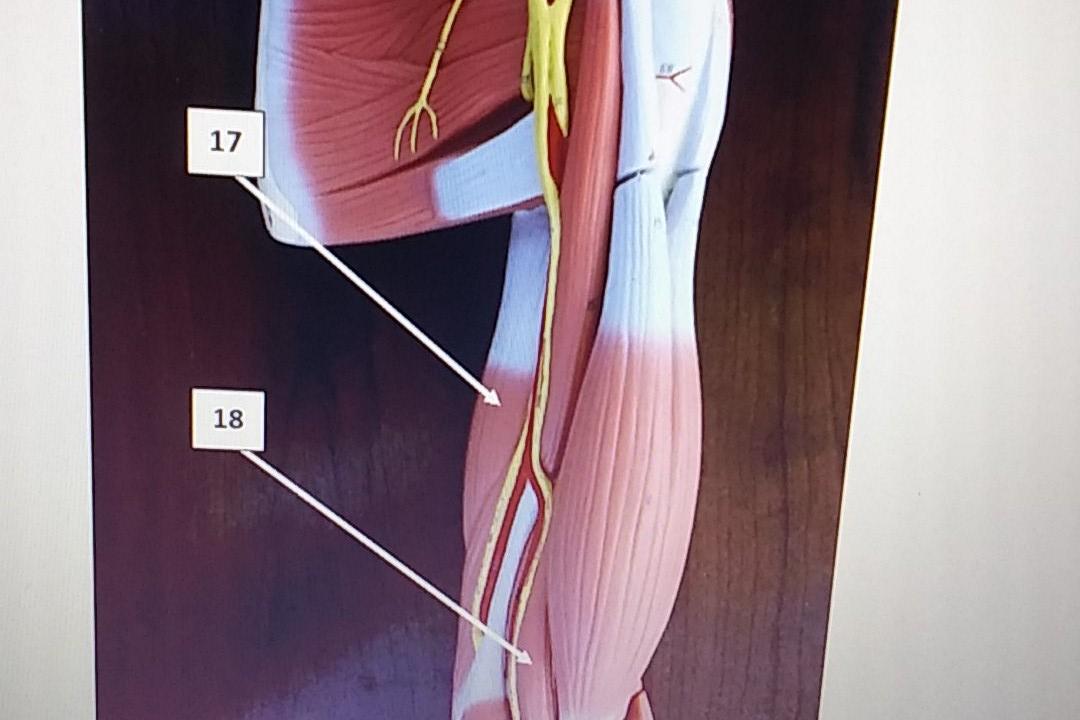 Solved 12. The runs through the bicipital groove. A.