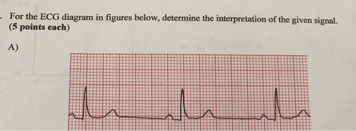 Solved For The ECG Diagram In Figures Below, Determine The | Chegg.com