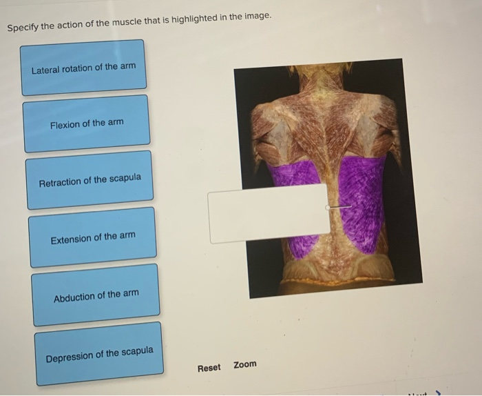 Solved Specify the action of the muscle that is highlighted