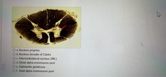 Solved a. Nucleus proprius b. Nucleus dorsalis of Clarke Oc | Chegg.com