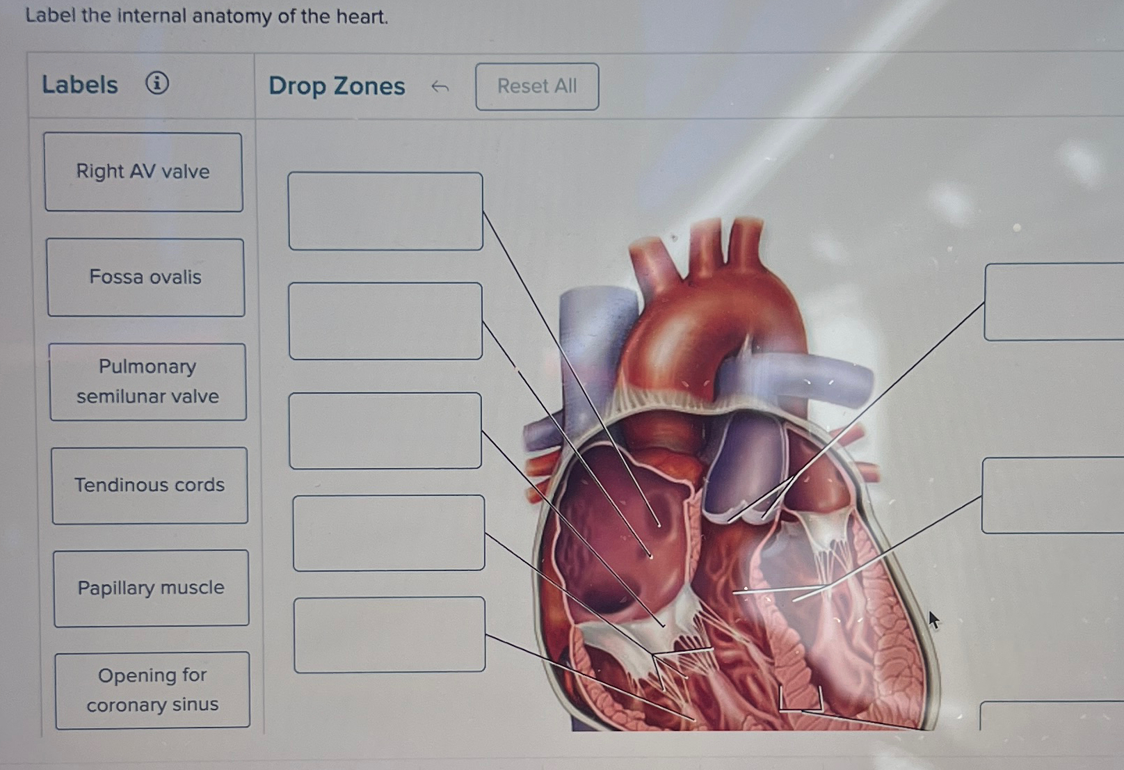 Label the internal anatomy of the heart.Labels(i)Drop | Chegg.com