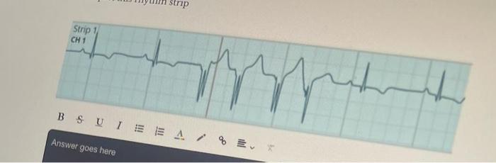 Interpret this rhythm strip could you trying this | Chegg.com