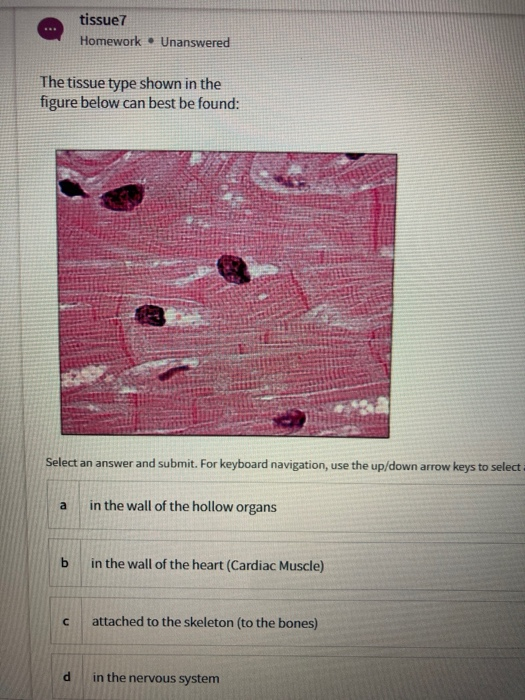 Solved х Identify the type of tissue show in the figure: А | Chegg.com