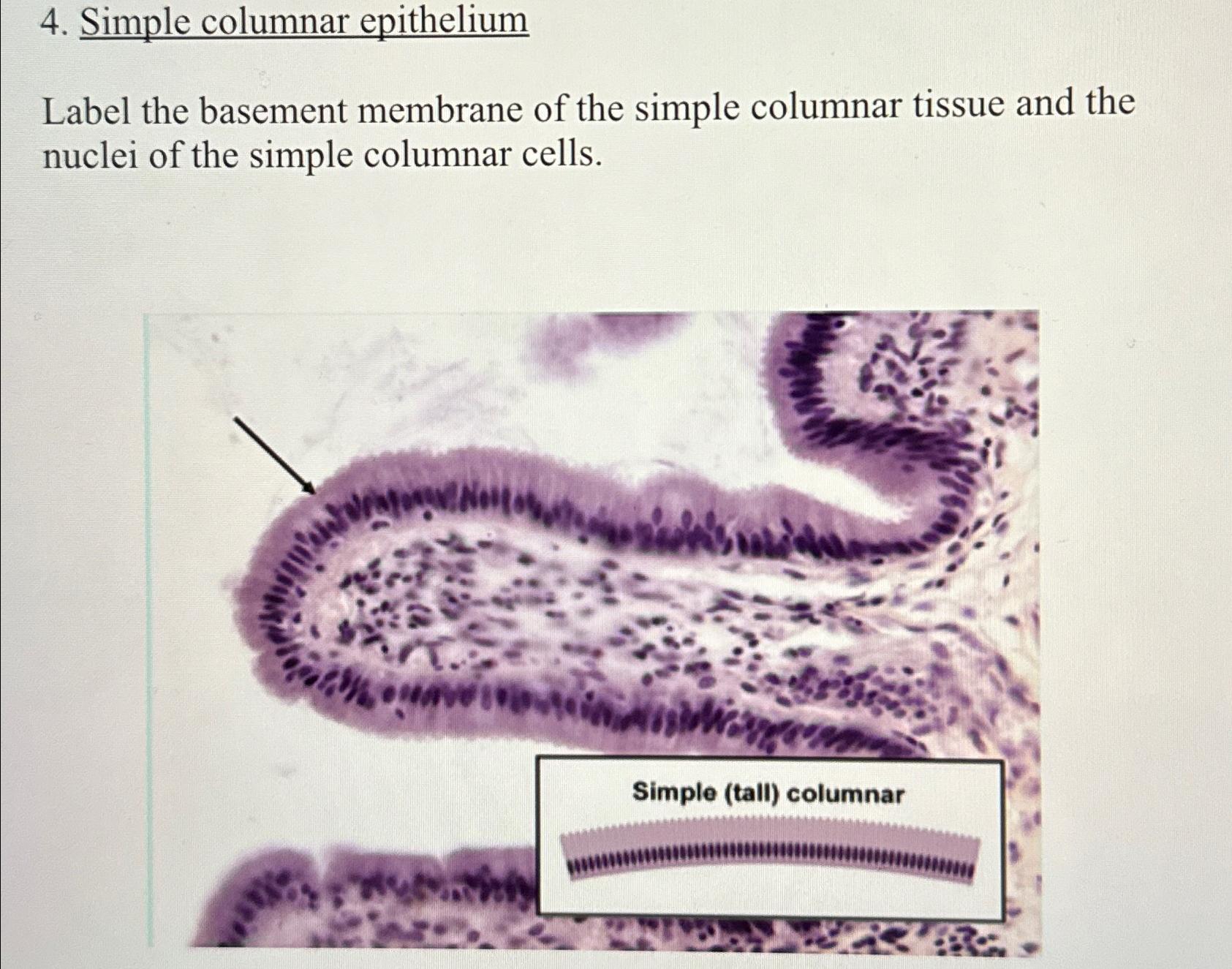 Solved Simple columnar epitheliumLabel the basement membrane