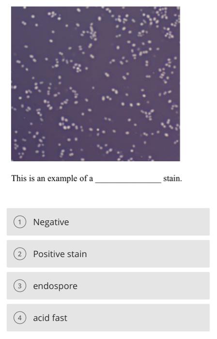 Solved A B ∞Identify this stain. Endospore capsule Gram | Chegg.com