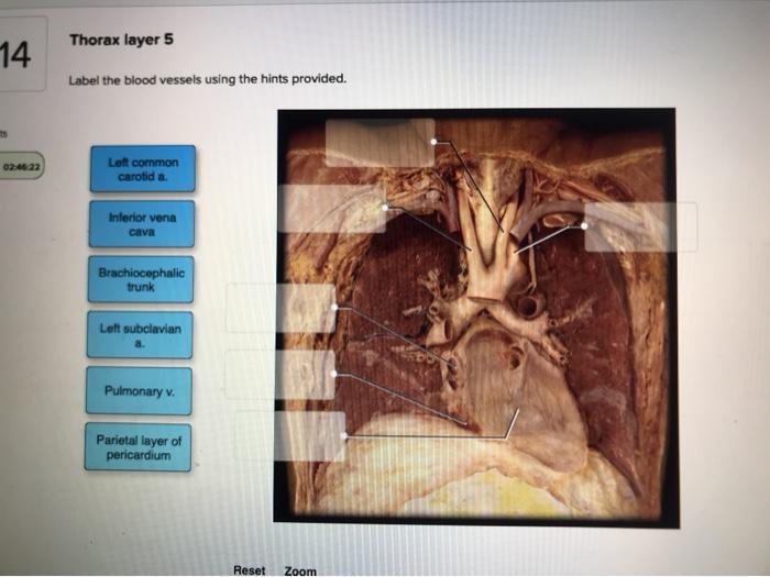 Solved Thorax layer 5 14 Label the blood vessels using the | Chegg.com