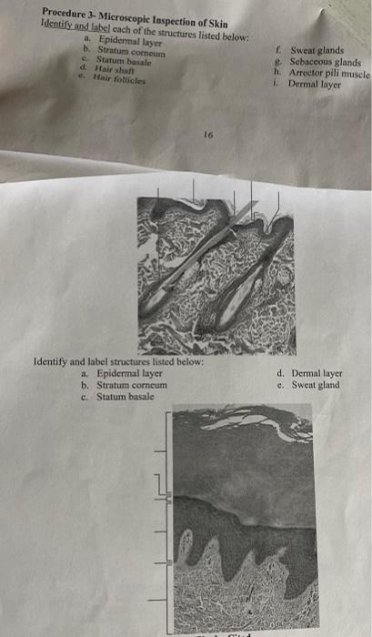 Solved Procedure - Microscopic Inspection of Skin Identify | Chegg.com