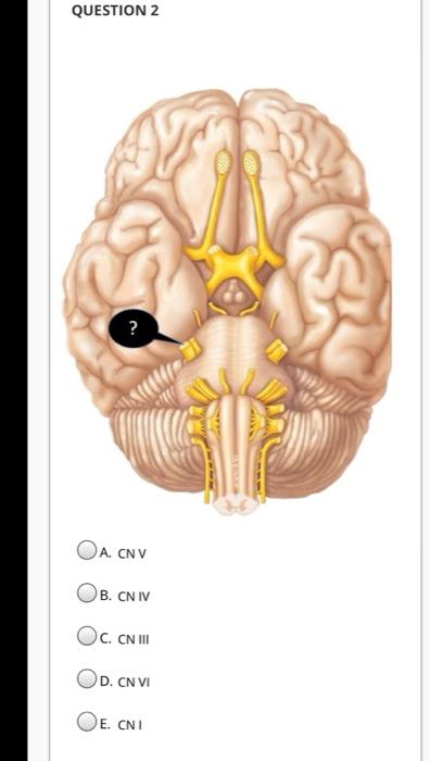 Solved QUESTION 1 The trigeminal nerve innervates muscles of