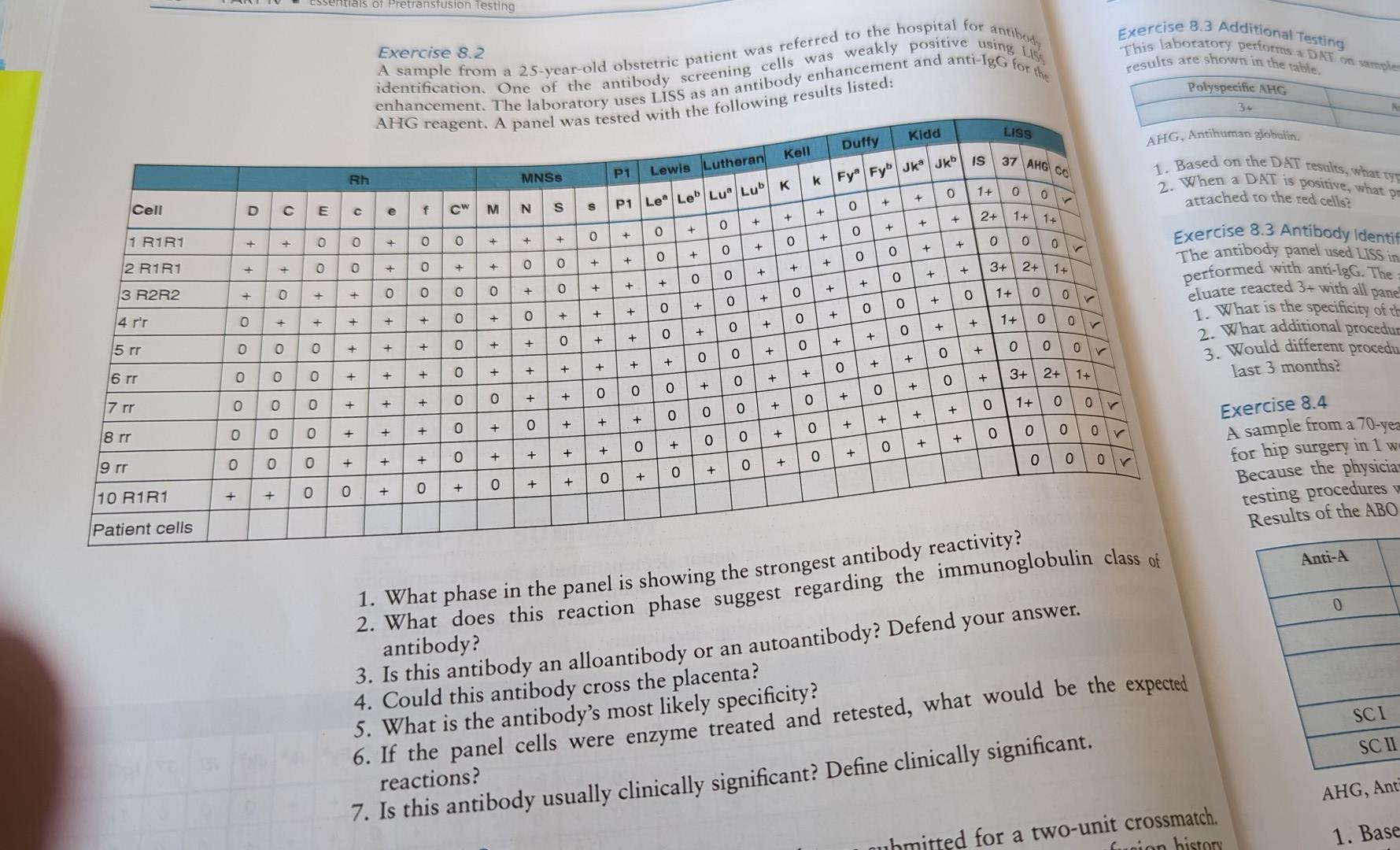 Exercise 8.2 A Sample From A 25 -year-old Obstetric 