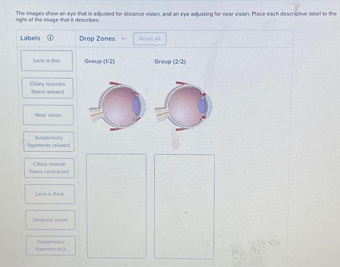 Solved The images show an eye that is adjusted for distance | Chegg.com