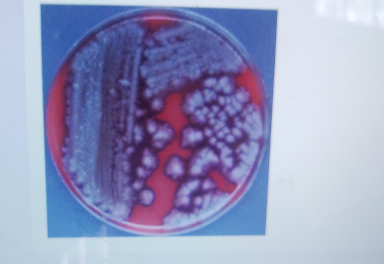 Solved Which organism would exhibit alpha hemolysis?