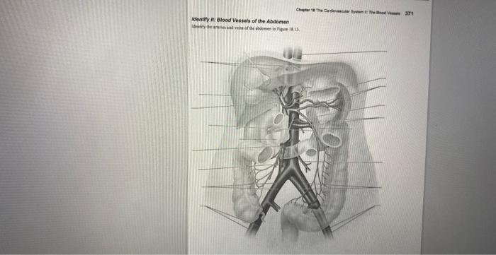 Identify It: Blood Vessels of the Upper and Lower | Chegg.com