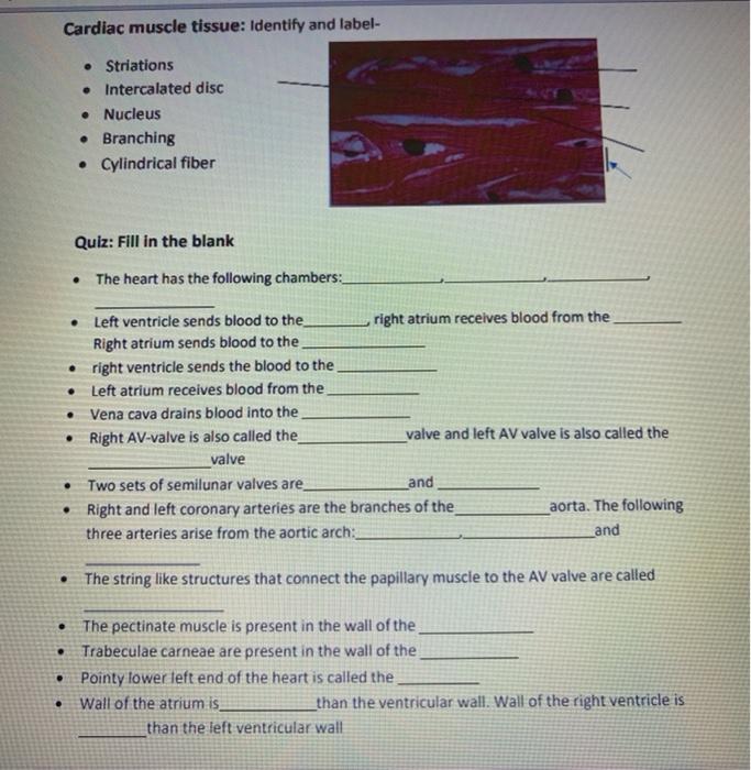Solved Cardiac muscle tissue Identify and label •