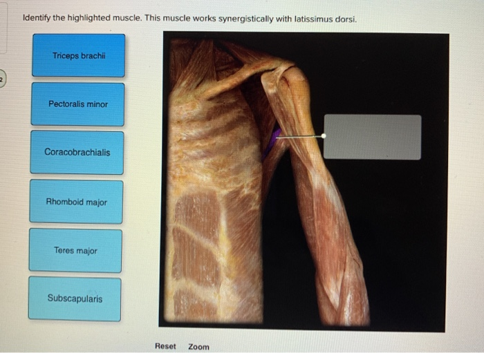 Solved Identify the highlighted muscle. This muscle works | Chegg.com