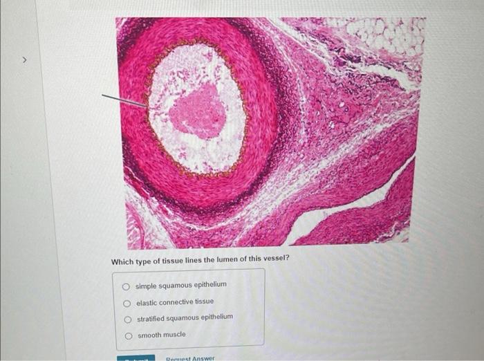 solved-which-type-of-tissue-lines-the-lumen-of-this-vessel-chegg