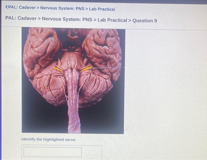 Solved 〈PAL: Cadaver > Nervous System: PNS > Lab Practical | Chegg.com