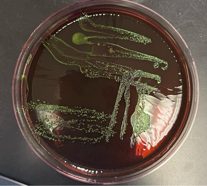 Solved Nake obsenvations of the colonies observed on the EMB | Chegg.com