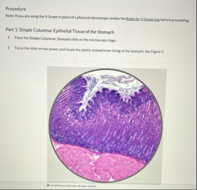 Solved ProcedureNote: If you are using the V-Scope in place | Chegg.com
