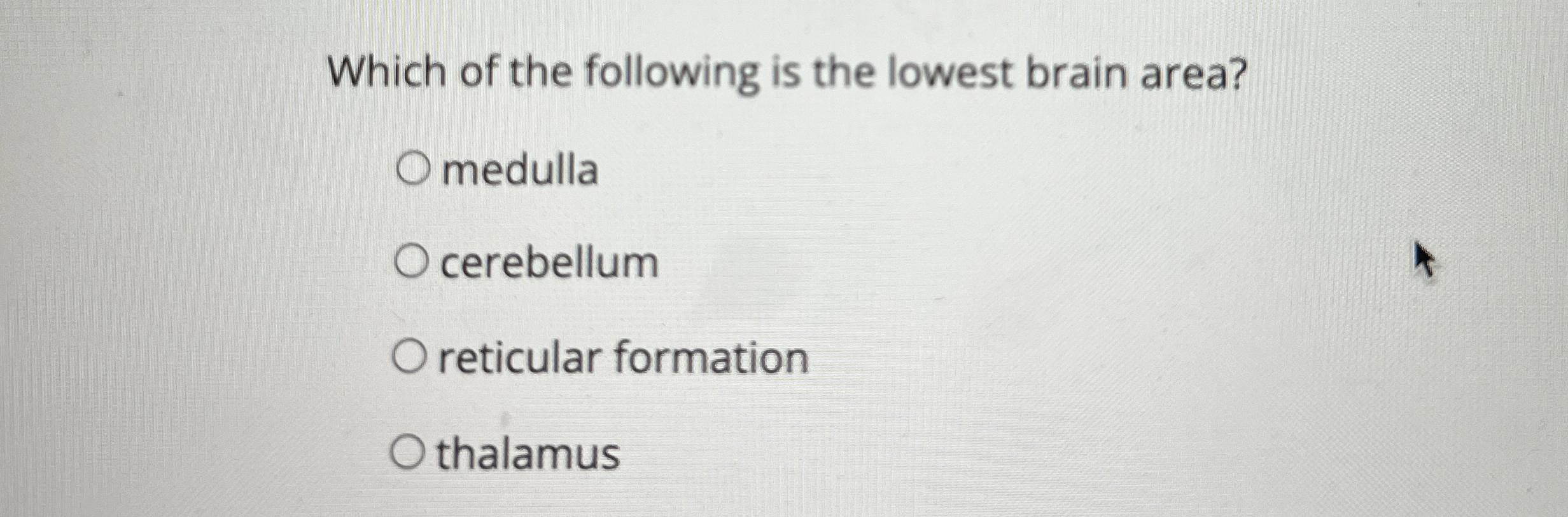 Solved Which of the following is the lowest brain | Chegg.com