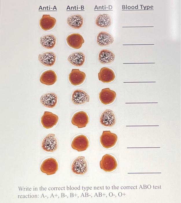 Solved Anti-A Anti-B Anti-D Blood Type Write in the correct | Chegg.com