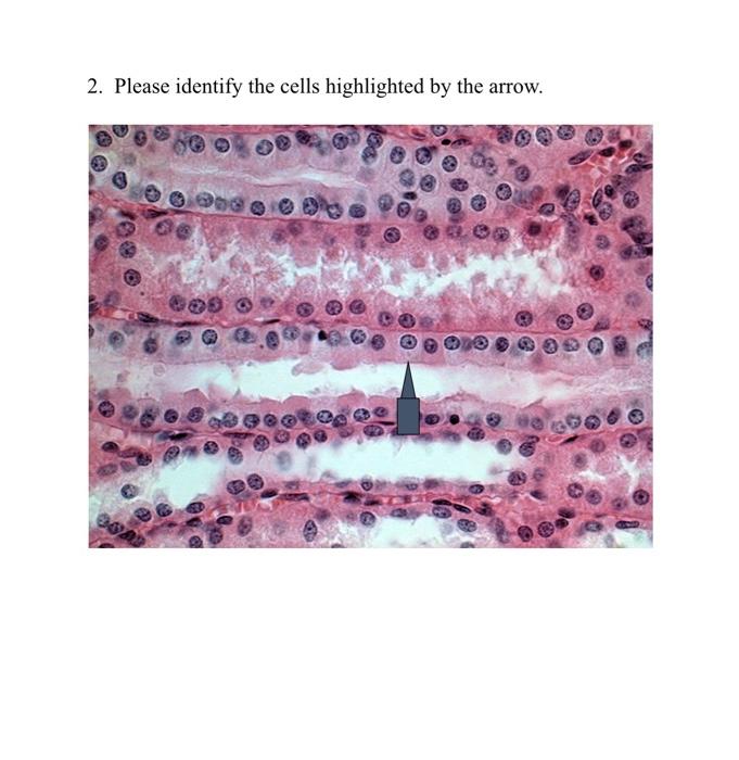 solved-2-please-identify-the-cells-highlighted-by-the-a