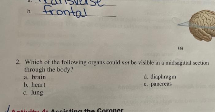 Solved B. 2. Which Of The Following Organs Could Not Be | Chegg.com