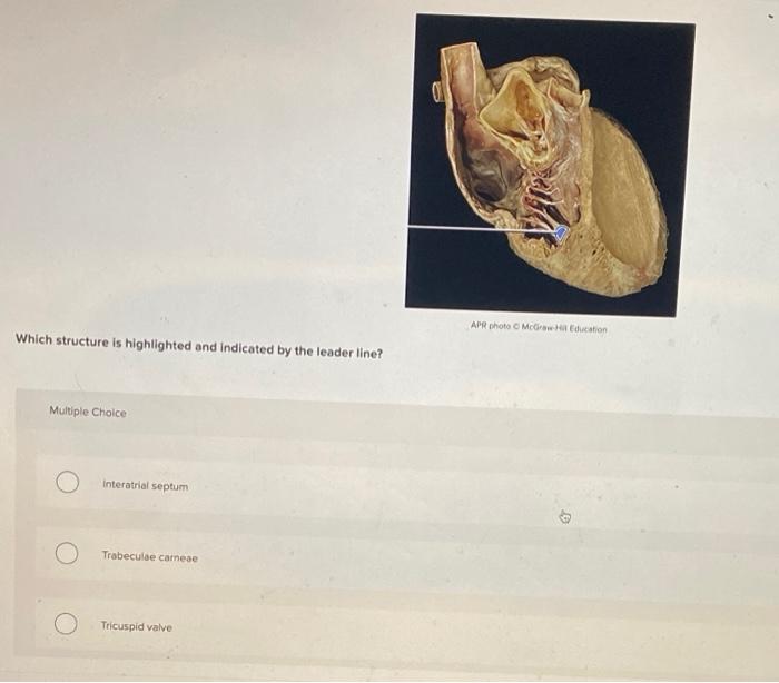 Solved 0 APR photo McHucation Which structure is highlighted