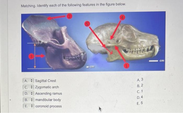 Solved Matching. Identify Each Of The Following Features In | Chegg.com