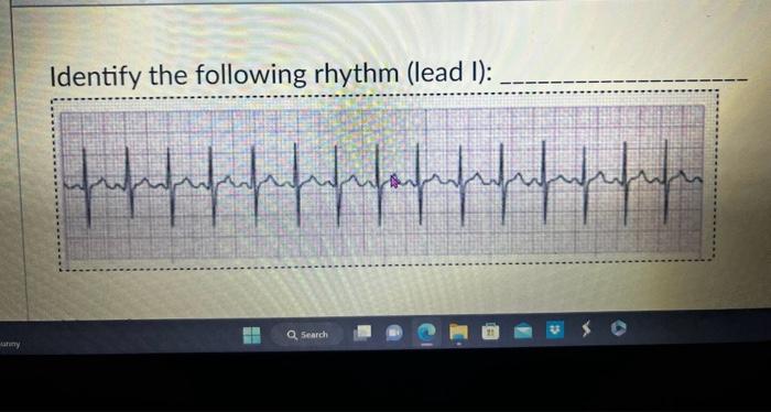 Solved Identify the following rhythm (lead I): | Chegg.com