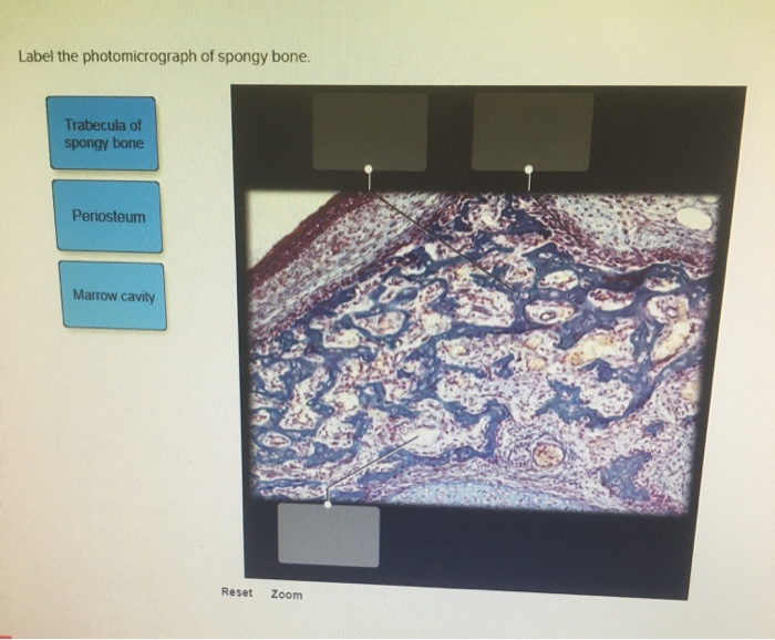 Solved Label the photomicrograph of spongy bone. Trabecula