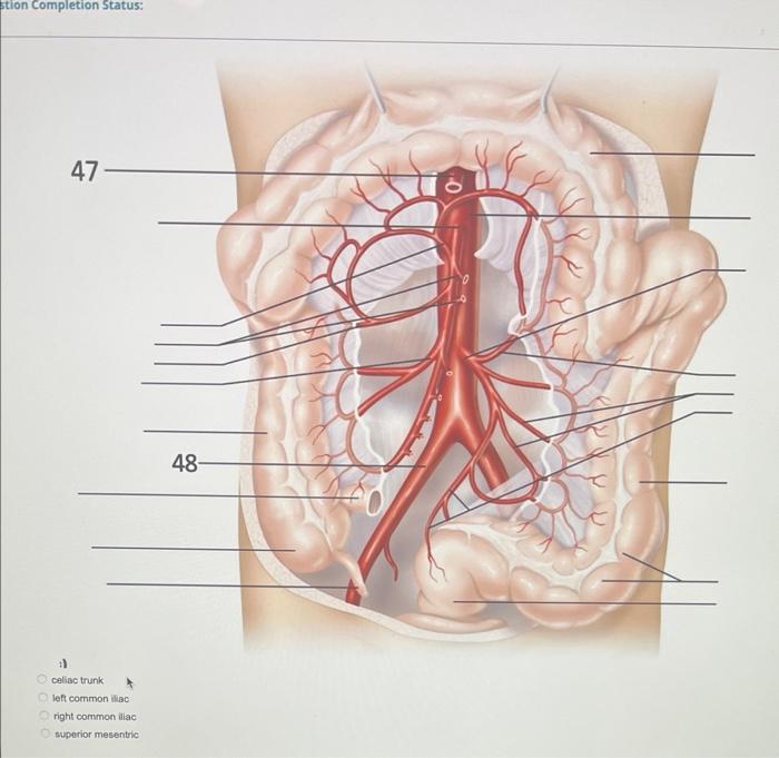 Stion Completion Status: celise trunk left common lise right commont iliac superior mesentric