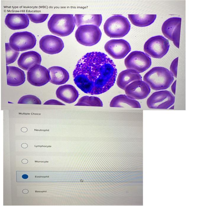 List 92+ Pictures What Type Of Leukocyte (wbc) Do You See In This Image ...