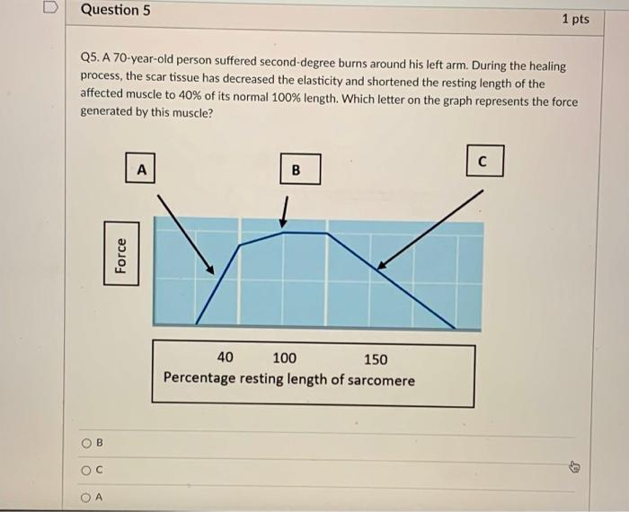 Solved D Question 7 1 pts Q7. Which of the following is a | Chegg.com