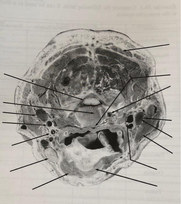 Solved Exercise 10-3. Sectional Anatomy Practice. Identify Biology Diagrams