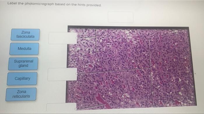 Solved Label the photomicrograph based on the hints provided | Chegg.com