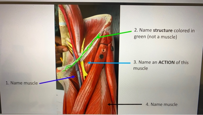 Solved 2. Name structure colored in green (not a muscle) 3. | Chegg.com