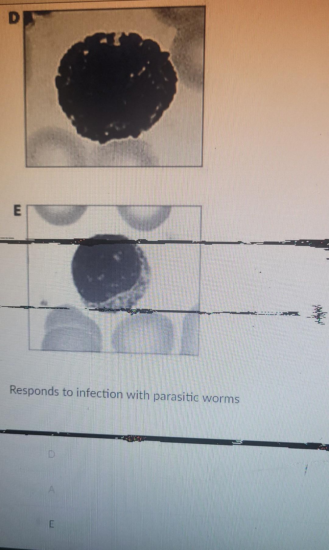 Responds To Infection With Parasitic Worms Responds Chegg Responds To Infection With Parasitic Worms Responds Chegg
