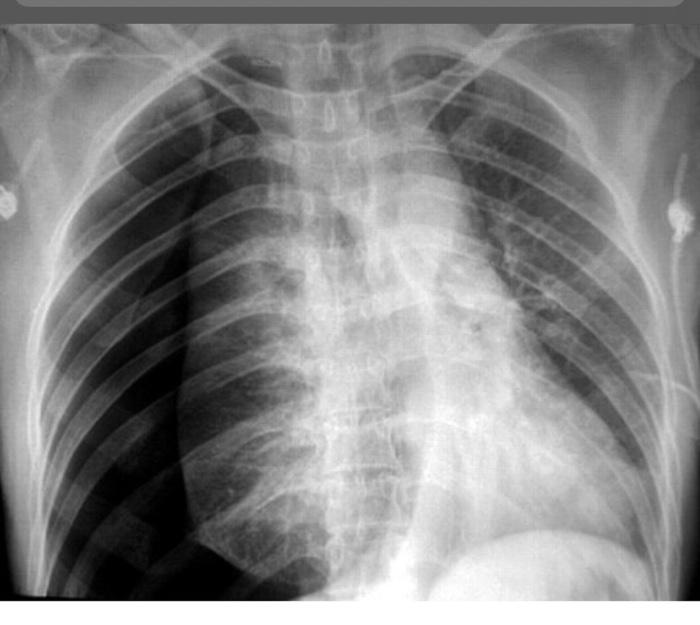 Solved can you interpret the xrays???