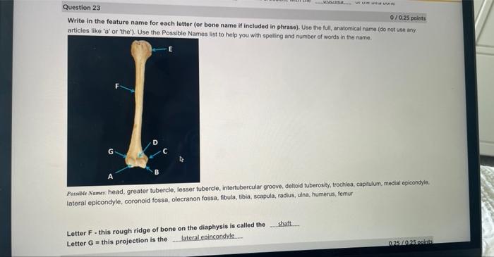 Solved Write in the feature name for each letter (or bone | Chegg.com