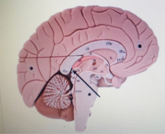 brain epithalamus