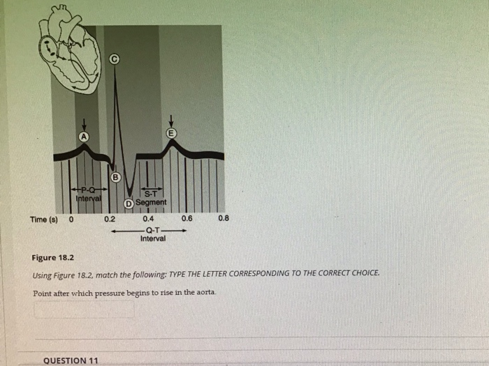 Solved C M +P-Q Interval Time (S) 0 0.2 S-T D Segment 11 0.4 | Chegg.com Solved C M +P-Q Interval Time (S) 0 0.2 S-T D Segment 11 0.4 | Chegg.com