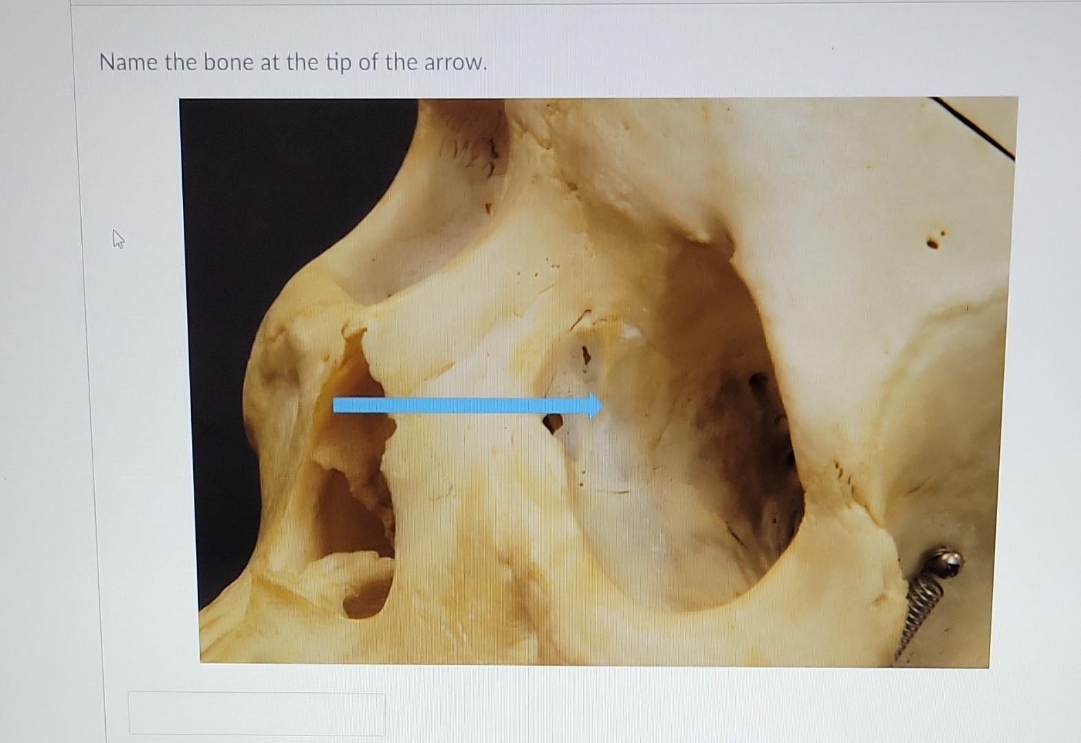 Tip Bone Solved Name the bone marker at the tip of the arrow. Name | Chegg.com