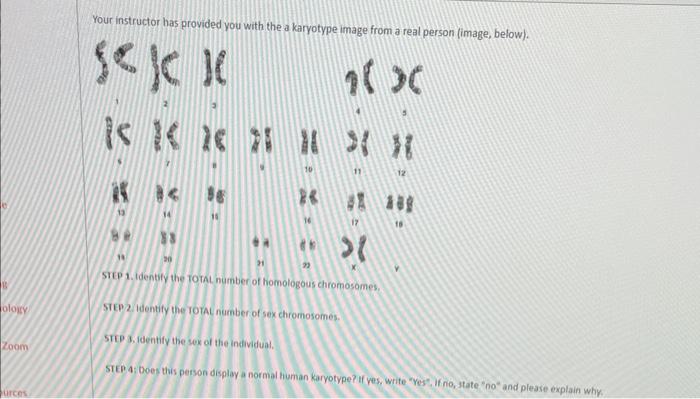 Your instructor has provided you with the a karyotype | Chegg.com