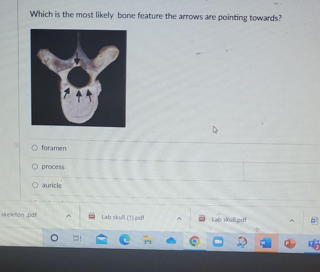 Solved Which is the most likely bone feature the arrows are | Chegg.com