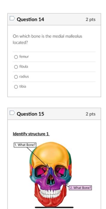 On which bone is the medial malleolus located?
\begin{tabular}{l} 
femur \\
\hline fibula \\
\hline radius \\
\hline tibia
\e