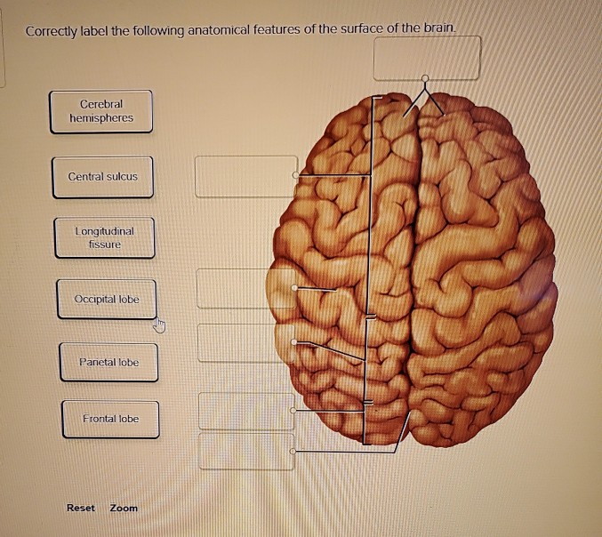 Solved Correctly label the following anatomical features of | Chegg.com