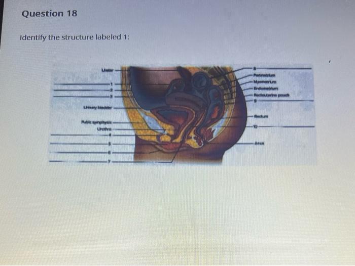 Solved Identify The Structure Labeled Identify The Chegg Com