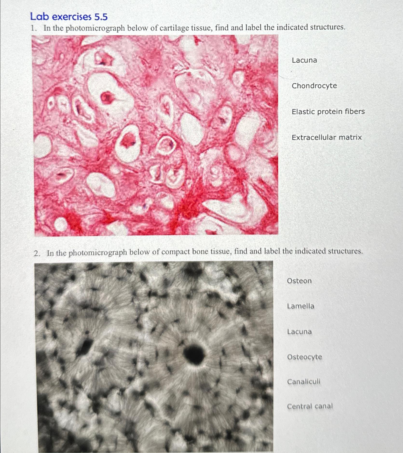Solved Lab exercises 5.5In the photomicrograph below of | Chegg.com