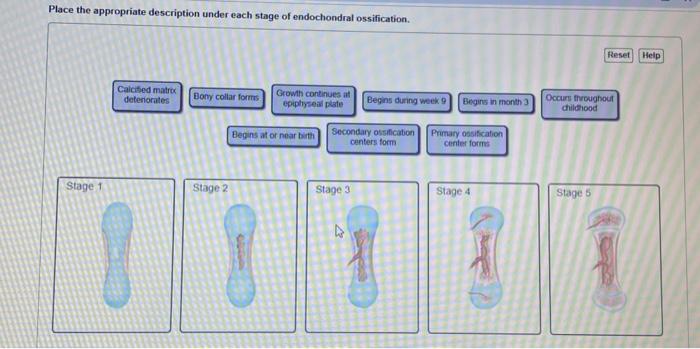 Solved Place The Appropriate Description Under Each Stage Of