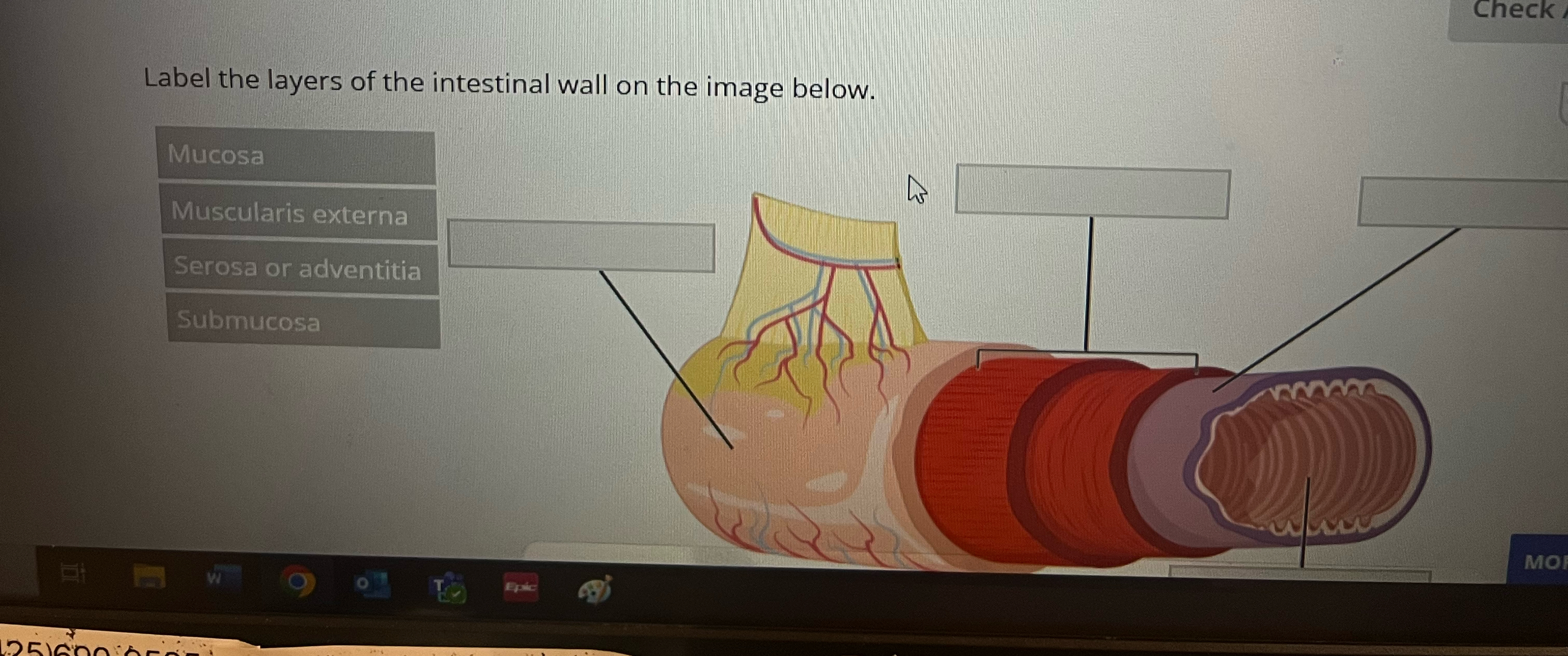 Solved Label the layers of the intestinal wall on the image | Chegg.com